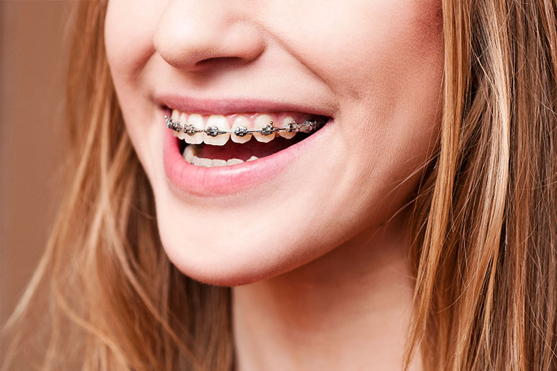 Orthodontics In Reston Va